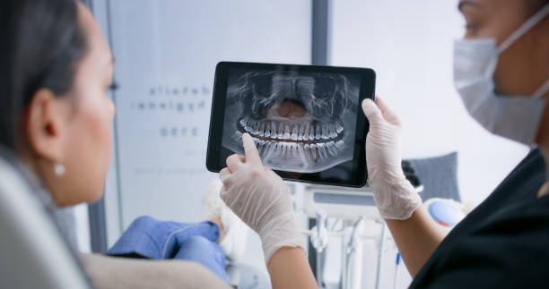 Best Chipped Tooth Repair Near Me  in Larkfield Wikiup, CA